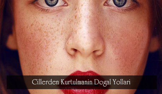 cillerden-kurtulmak-icin-dogal-yontemler