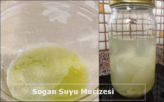 sogan-suyu-mucizesi flatcast tema