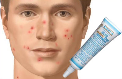 blue-herbal-spot-treatment-homme